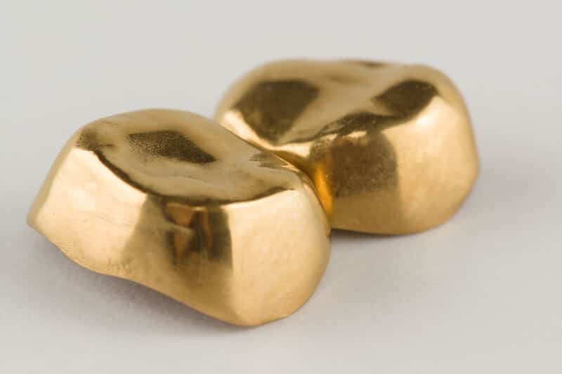 Zahngold
